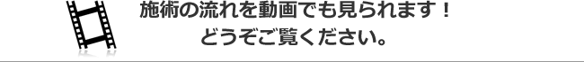施術の流れを動画でも見られます！どうぞご覧ください。